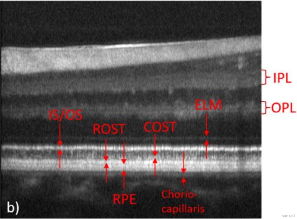 健康人眼黄斑区AO-OCT B-scan图像解读