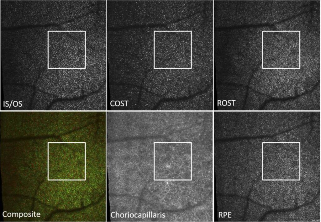 健康人眼黄斑区AO-OCT B-scan图像解读