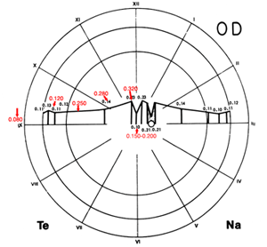 RetinalThickness